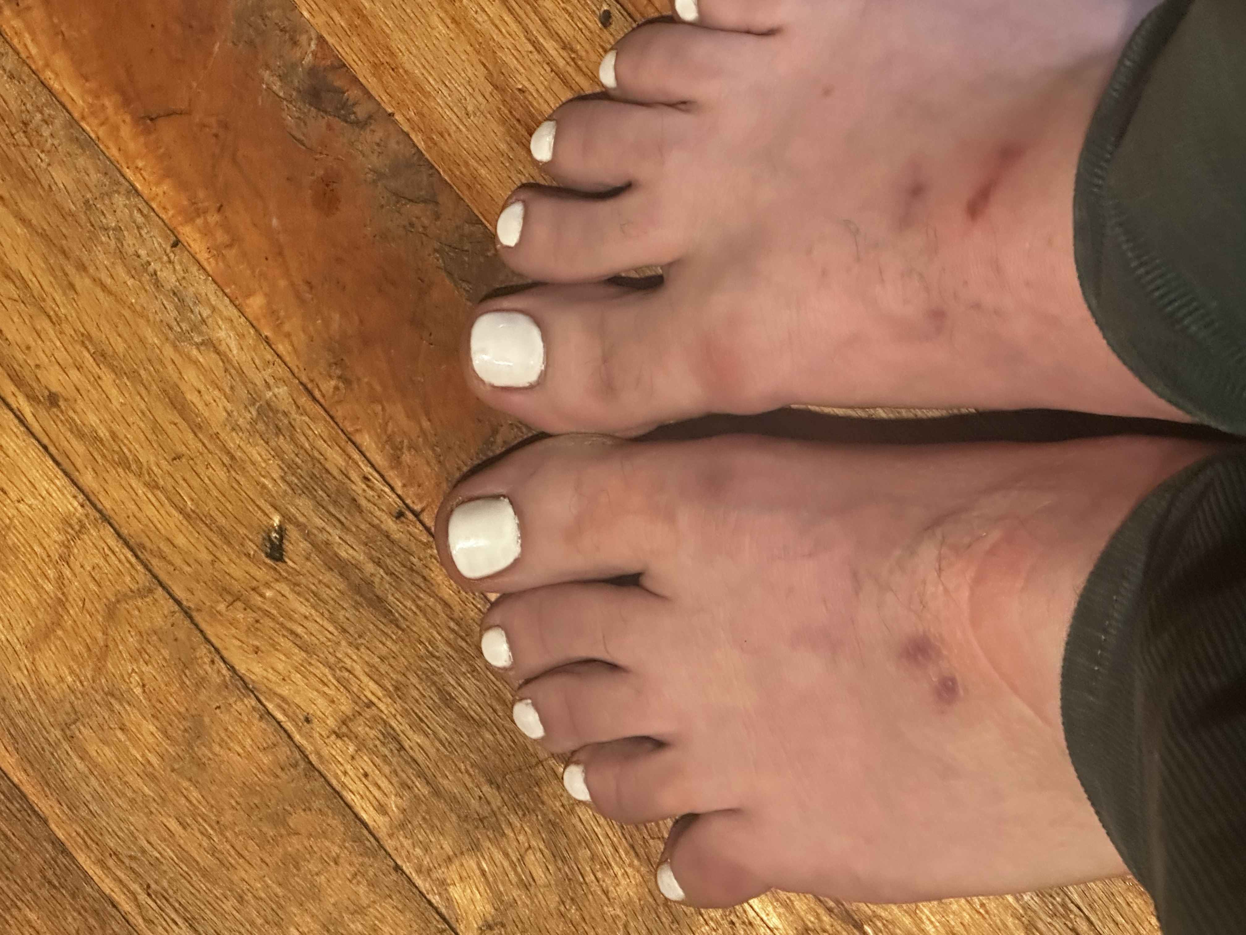 My Toes